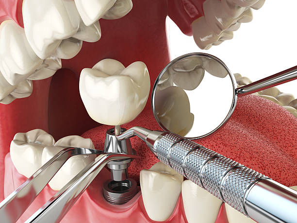 Best Emergency Orthodontic Repairs in Bakerstown, PA